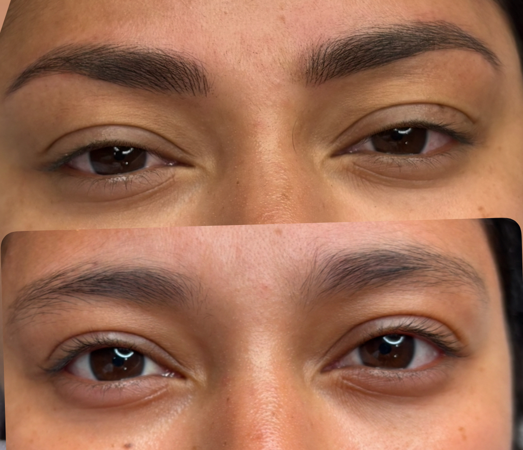 Antes y después · cejas