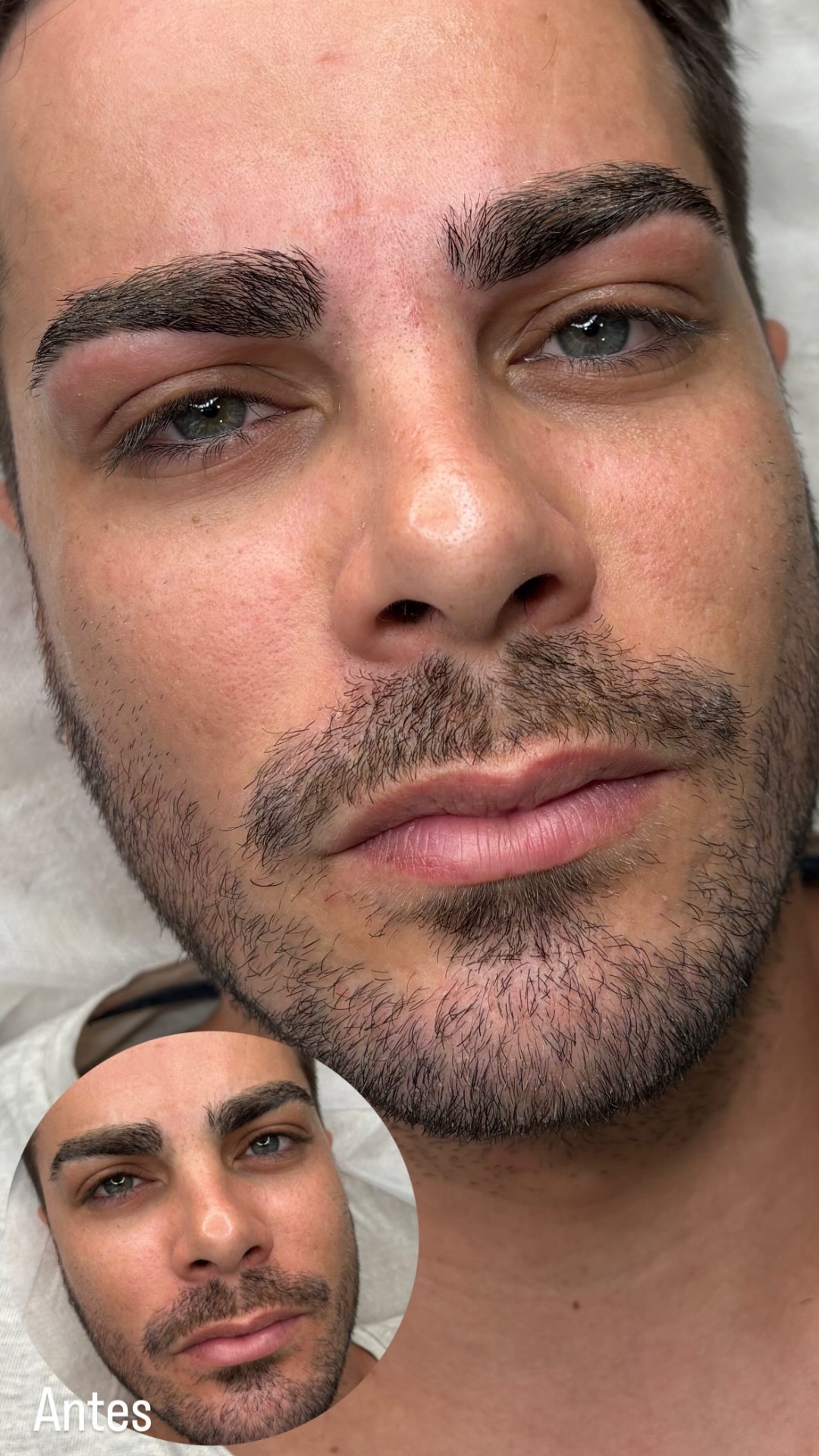 Micropigmentación masculina